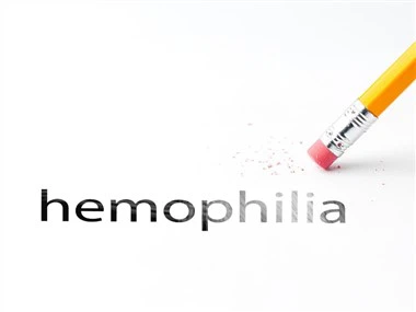 Hemofilija A modelis