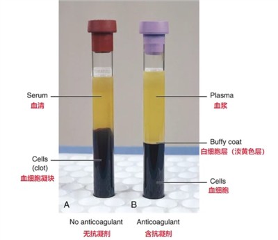 Serumas Vs. Plazma: Optimalios ikiklinikinės bioanalizės matricos pasirinkimas